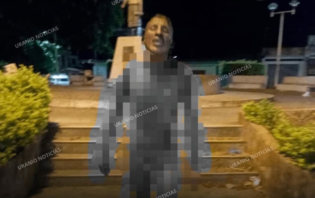 JOVEN ES ENCONTRADO DEAMBULANDO CON QUEMADURAS Y MUERE EN EL HOSPITAL DE TINGO MARÍA