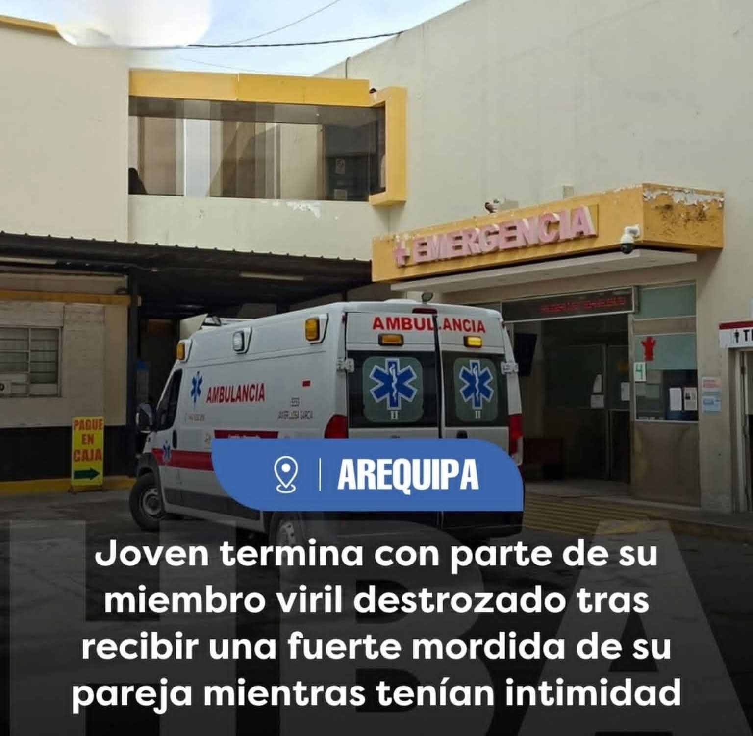 MUJER FURIOSA DE UNA MORDIDA LE ARRANCÓ PARTE DEL PENE A UN JOVEN ESTUDIANTE EN AREQUIPA